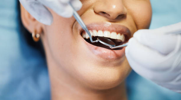 Best Urgent Care for Lost Fillings or Crowns in San Jacinto, CA